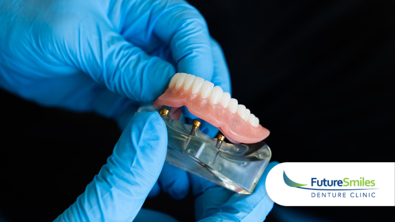 Denture Relining Services in Calgary: What to Expect 